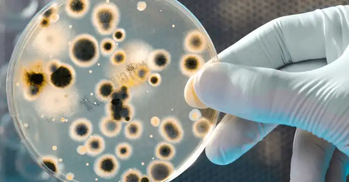 Petri dish breeding bacteria