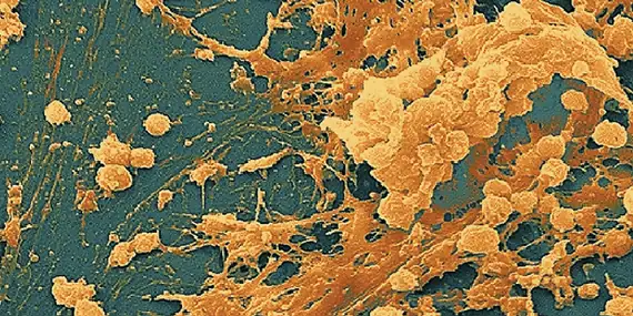 Biofilm under an electron microscope