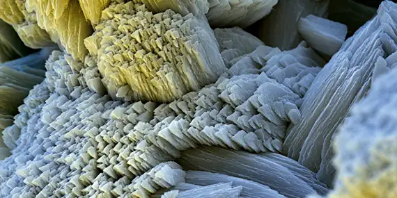 Limescale crystals under an electron microscope